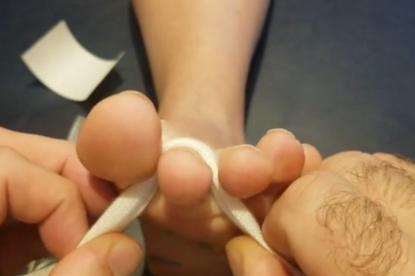 plantarflextoestrap1