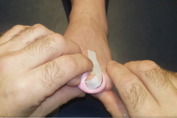 siliconecorrectivetoesplint4