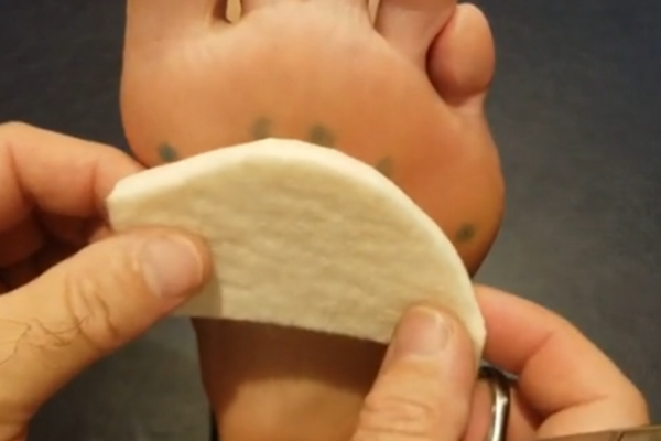 metatarsalbarpad1